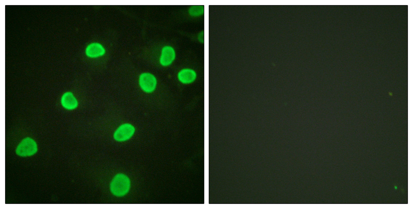 Histone H4 (Acetyl Lys5) Rabbit Polyclonal Antibody