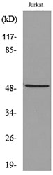 HNF-3α/β/γ (Acetyl Lys264/253/211) Rabbit Polyclonal Antibody