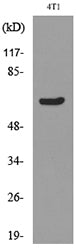 Ku-70 (Acetyl Lys331) Rabbit Polyclonal Antibody