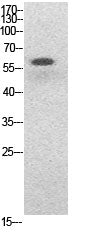 NFκB-p65 (Acetyl Lys314/Lys315) Rabbit Polyclonal Antibody