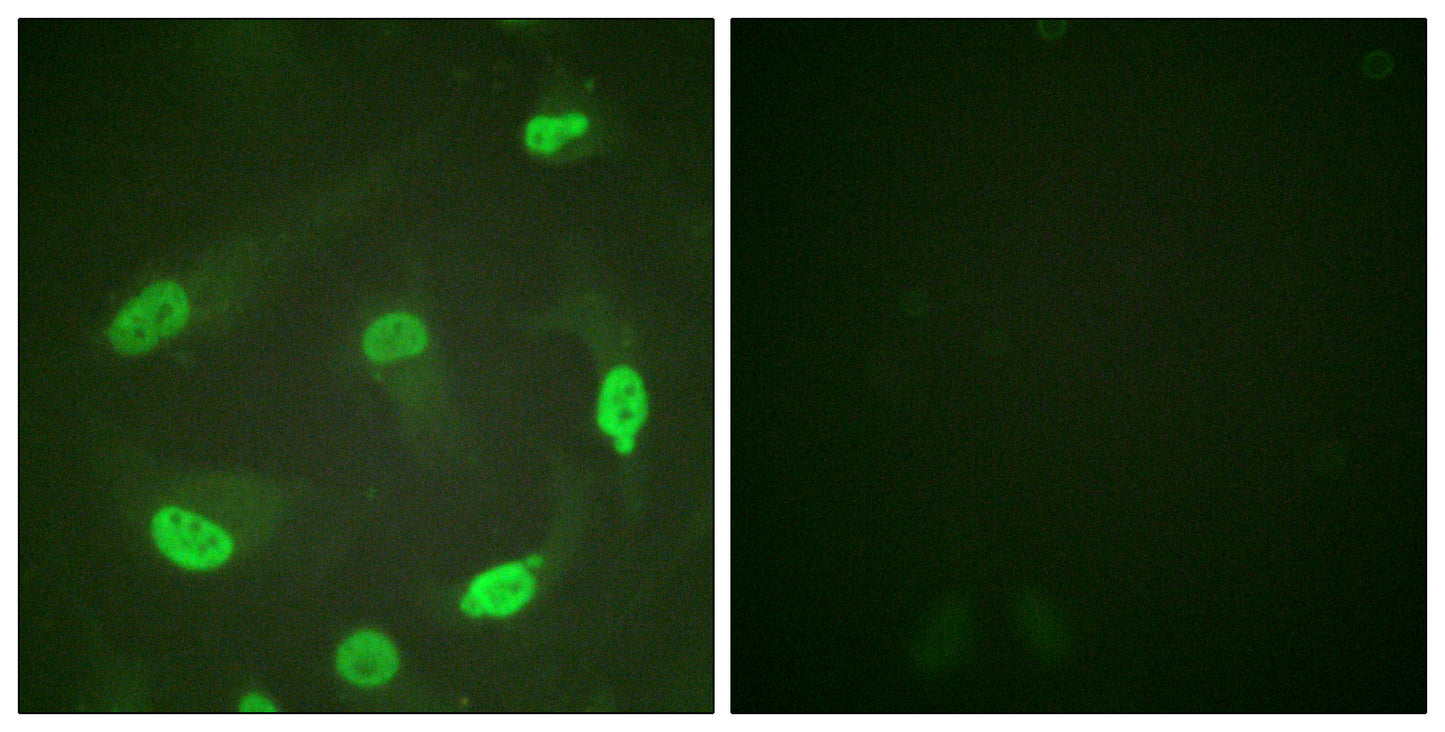 p53 (Acetyl Lys381) Rabbit Polyclonal Antibody