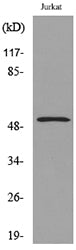 Tubulin α (Acetyl Lys40) Rabbit Polyclonal Antibody