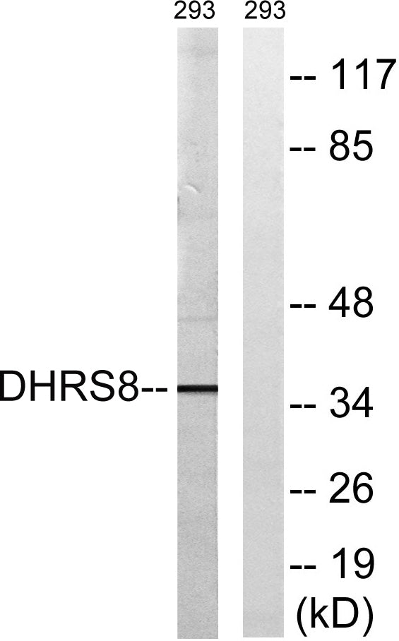 17β-HSD11 Rabbit Polyclonal Antibody