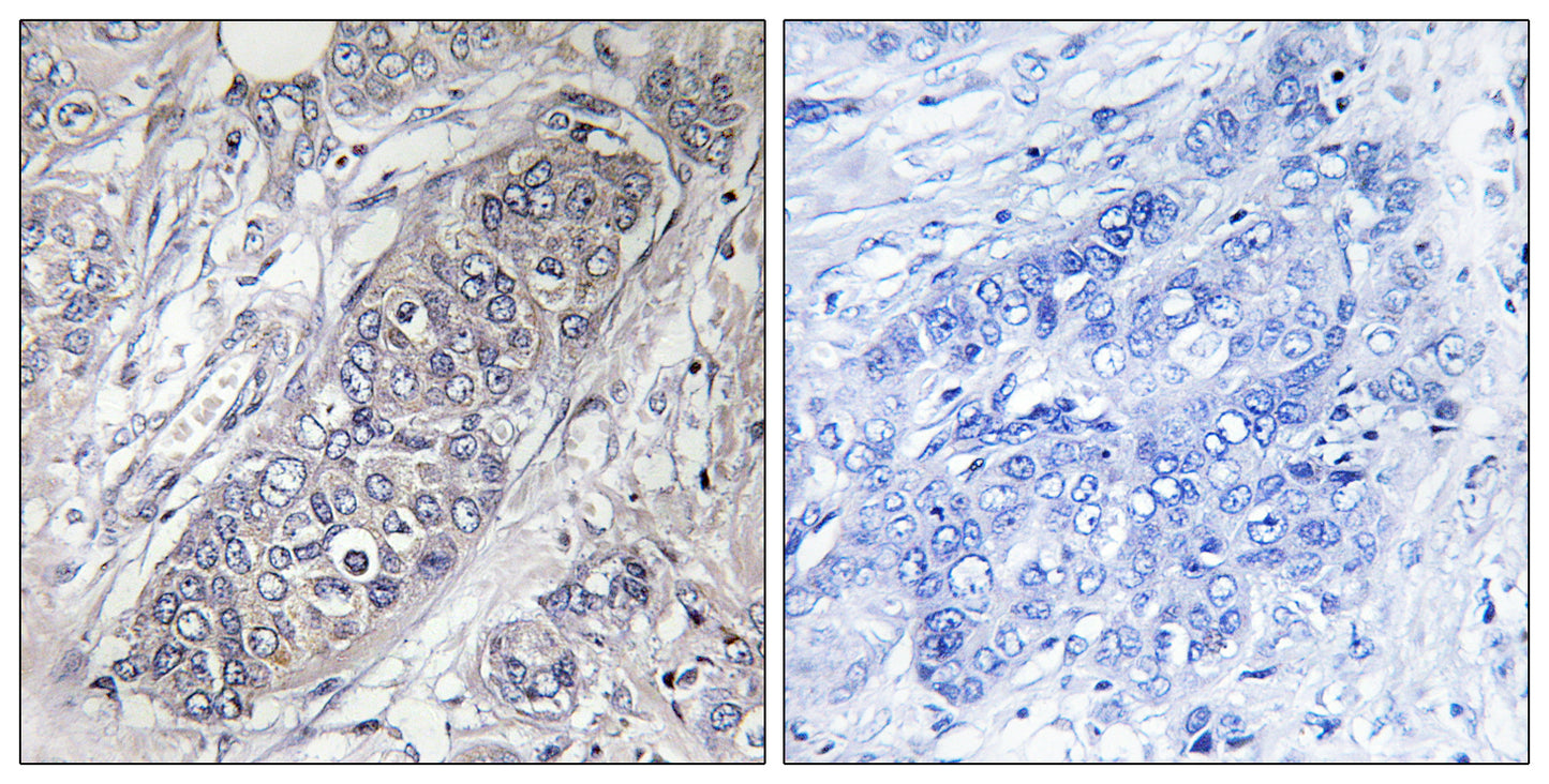 4E-BP1 Rabbit Polyclonal Antibody