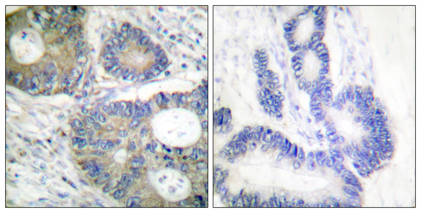 4E-BP1 Rabbit Polyclonal Antibody