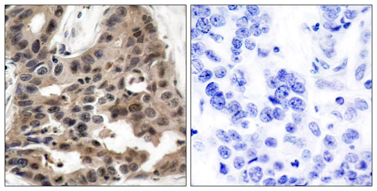 4E-BP1 Rabbit Polyclonal Antibody