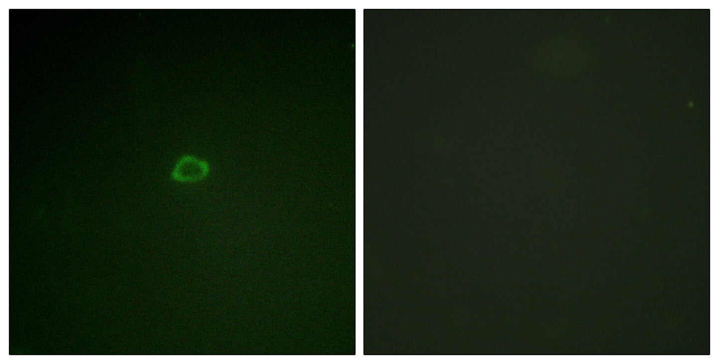 4E-BP1 Rabbit Polyclonal Antibody