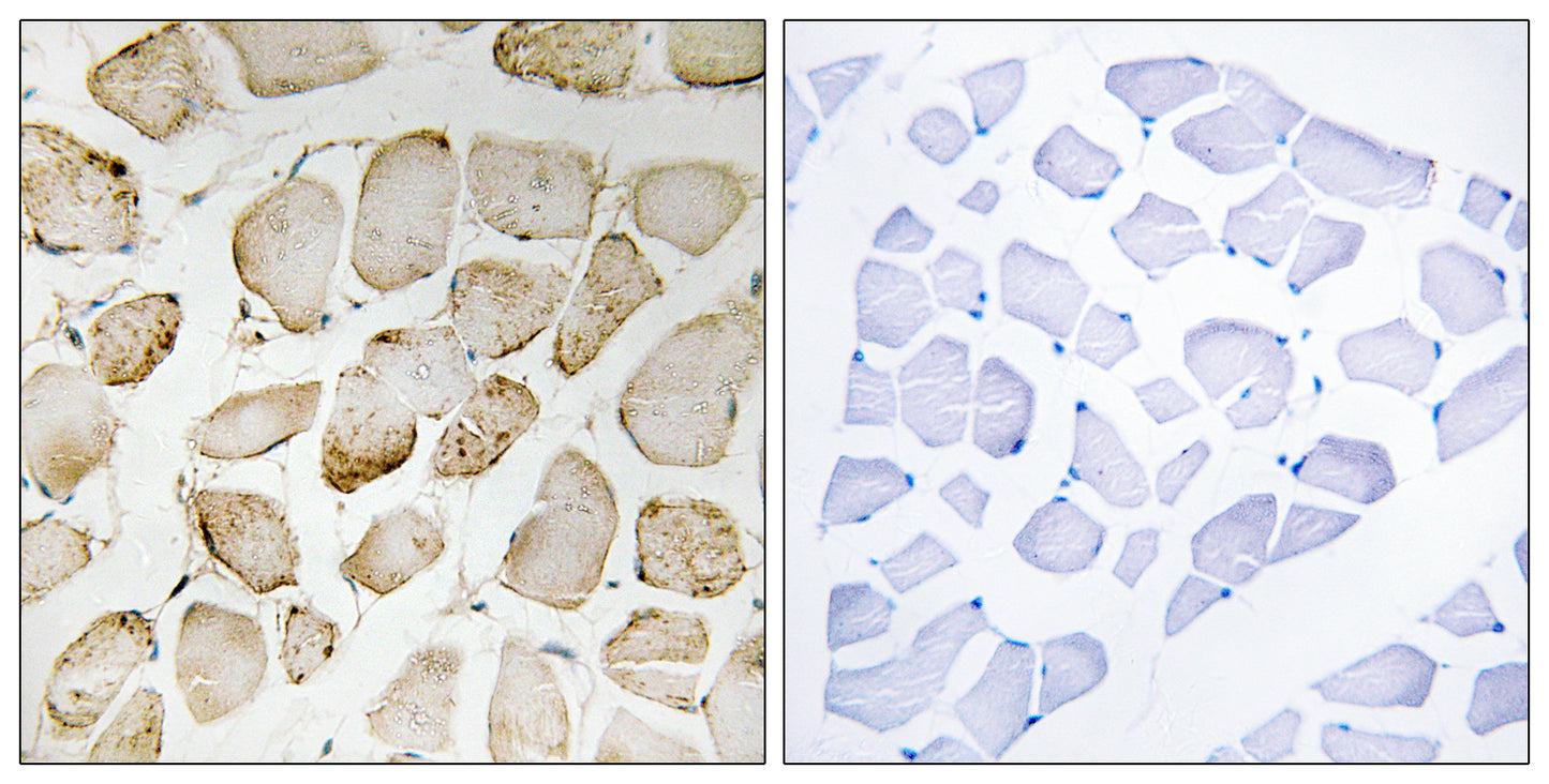 5-LO Rabbit Polyclonal Antibody