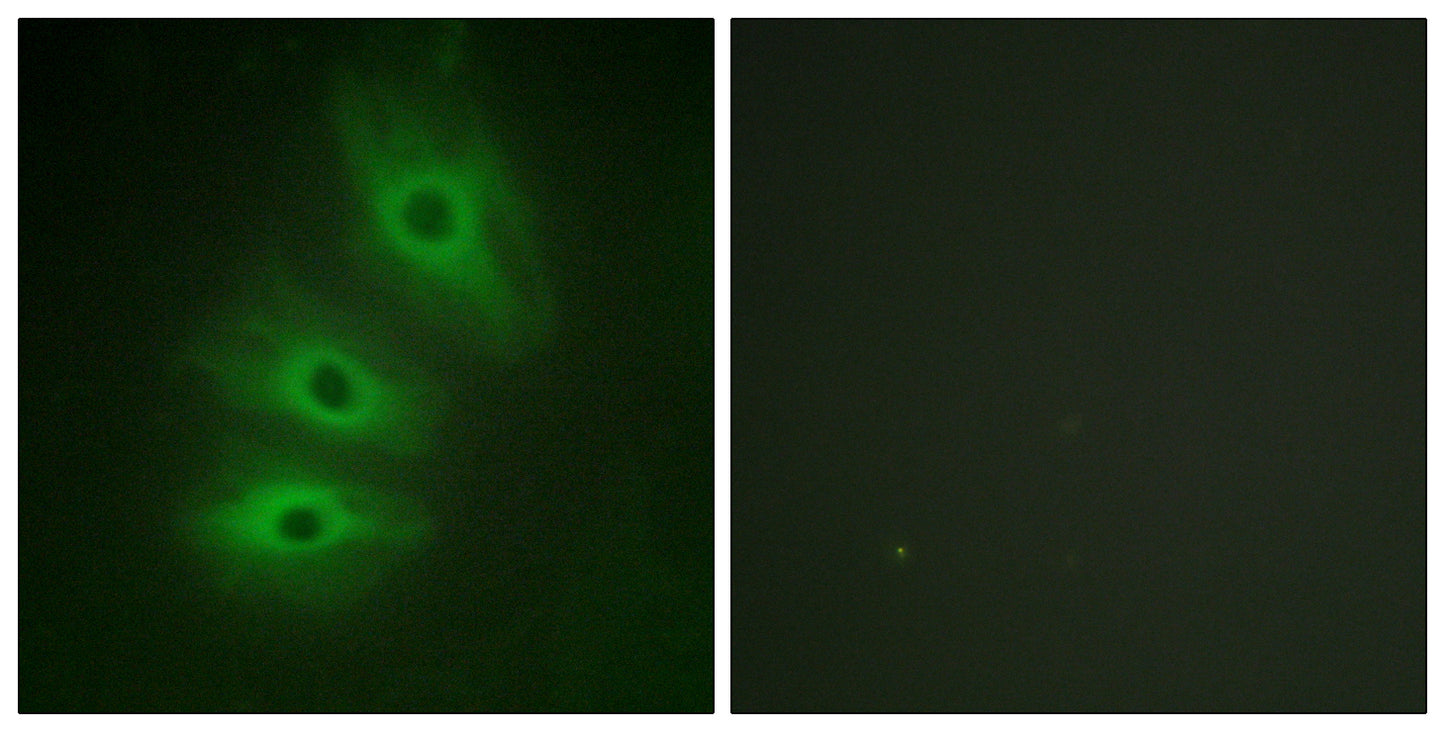 A Cyclase V/VI Rabbit Polyclonal Antibody