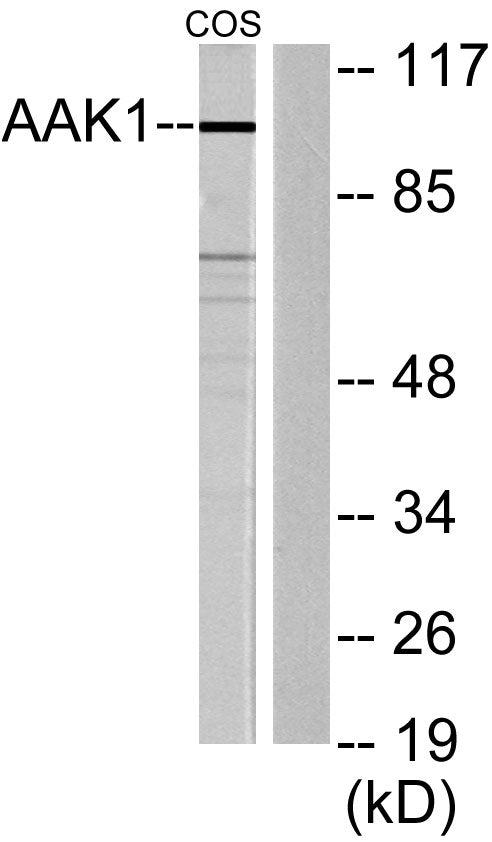 AAK1 Rabbit Polyclonal Antibody