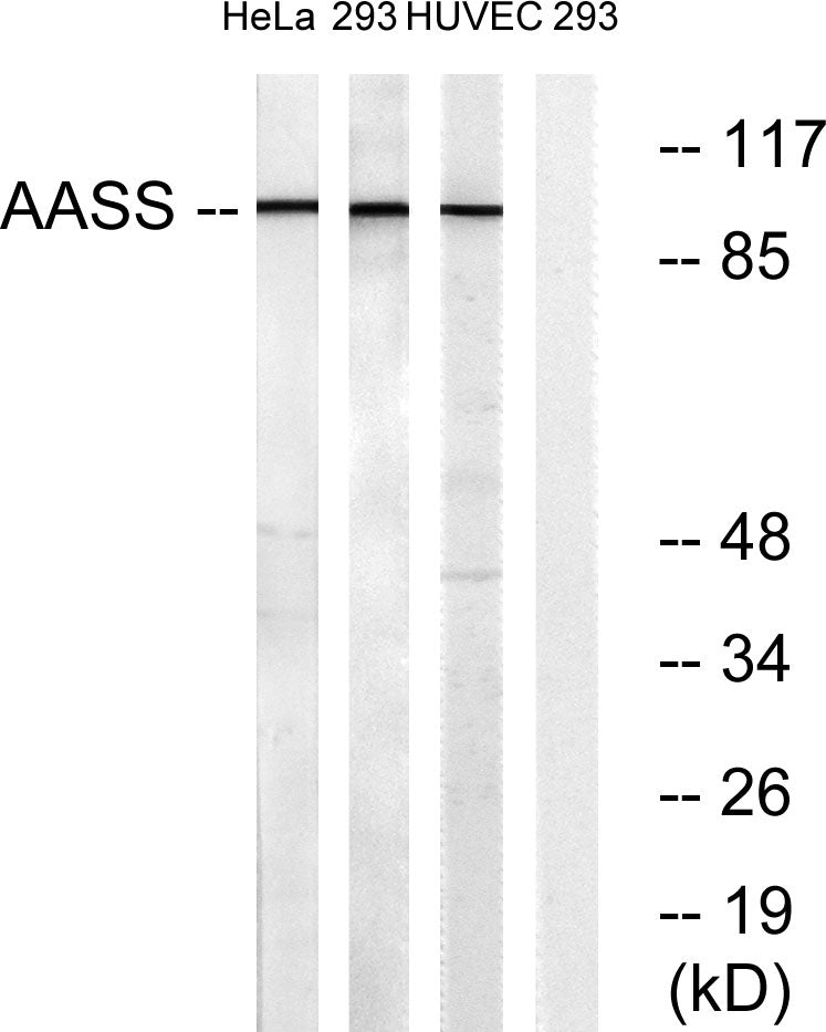 AASS Rabbit Polyclonal Antibody