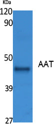 AAT Rabbit Polyclonal Antibody