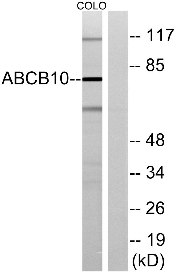 ABCB10 Rabbit Polyclonal Antibody