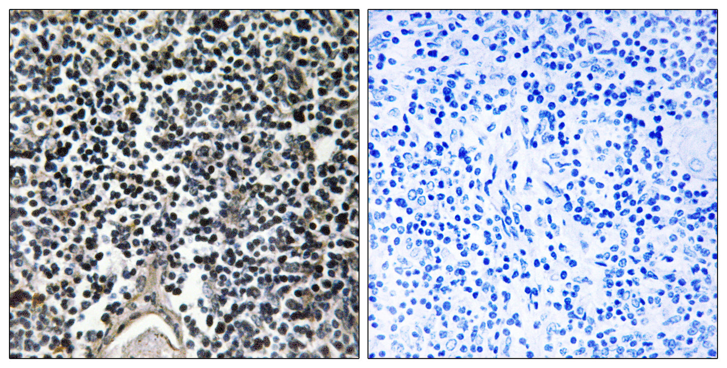 ABCB7 Rabbit Polyclonal Antibody