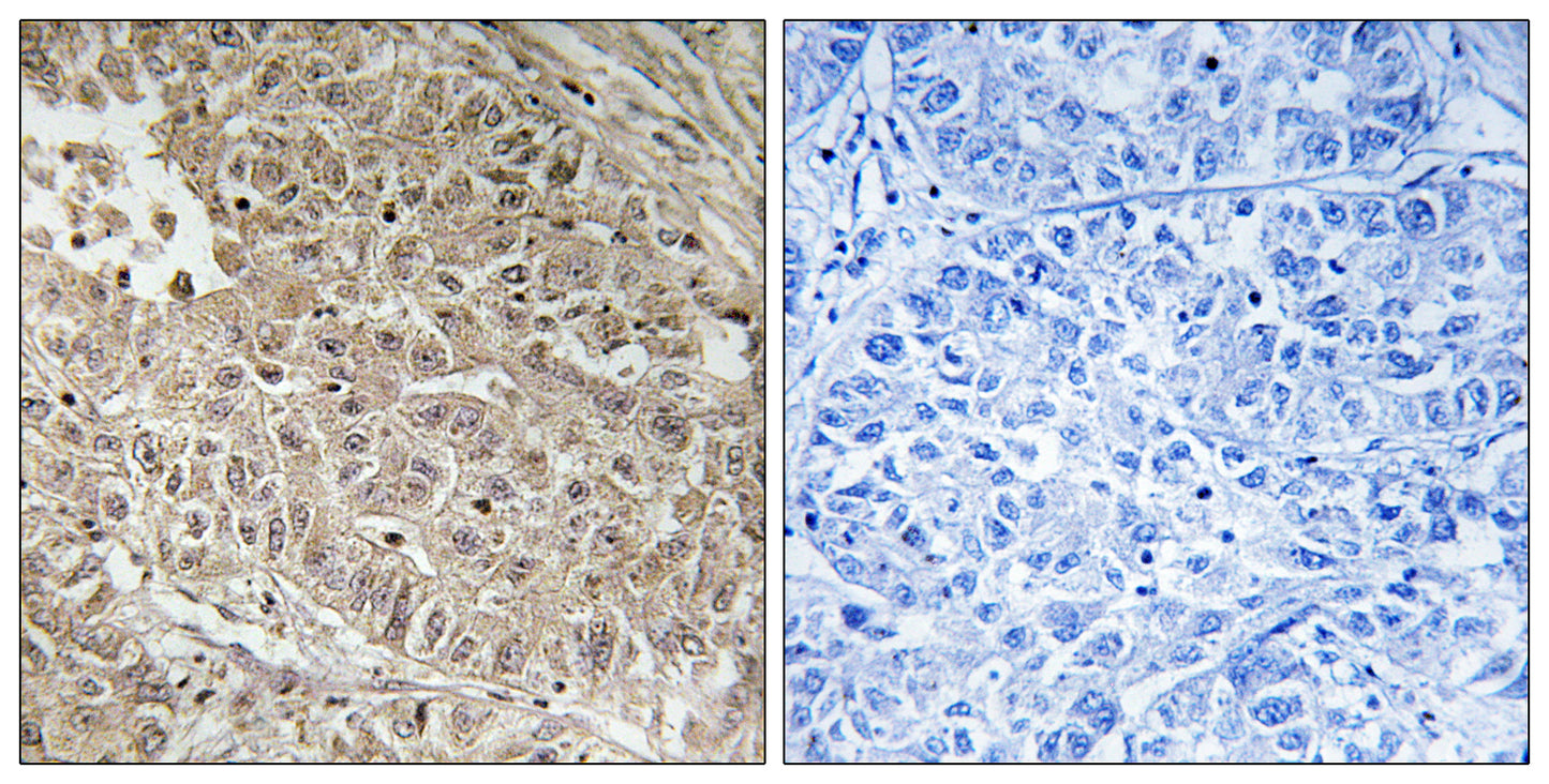 ABCC13 Rabbit Polyclonal Antibody