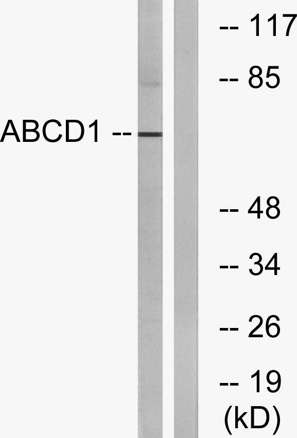 ABCD1 Rabbit Polyclonal Antibody