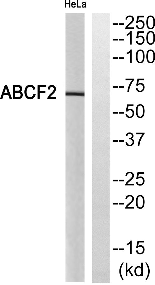 ABCF2 Rabbit Polyclonal Antibody