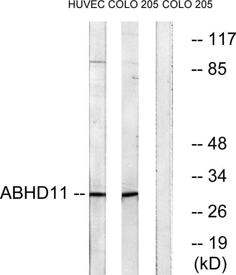 ABHD11 Rabbit Polyclonal Antibody
