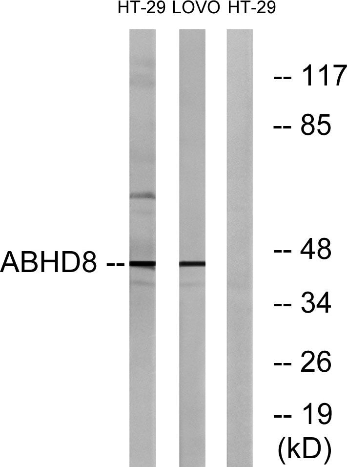 ABHD8 Rabbit Polyclonal Antibody