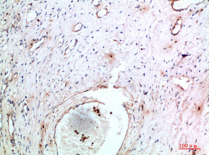 Abin-2 Rabbit Polyclonal Antibody