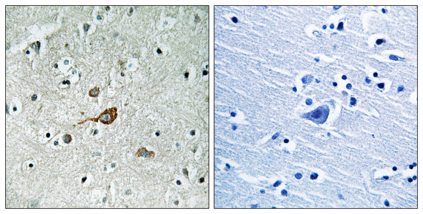 Abl1/2 Rabbit Polyclonal Antibody