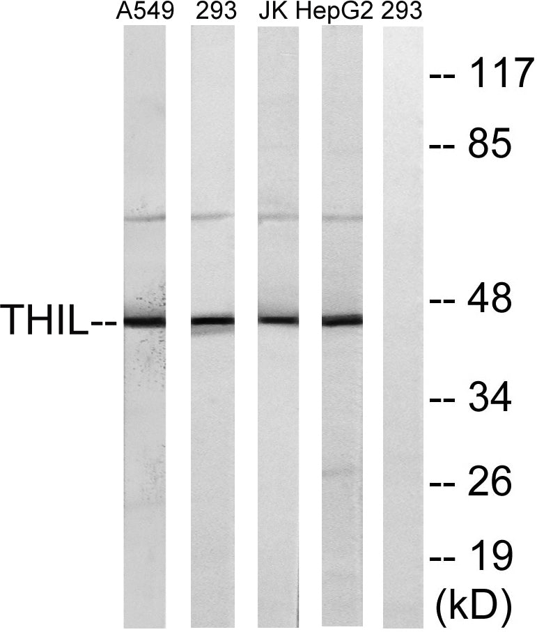 ACAT-1 Rabbit Polyclonal Antibody