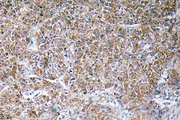 ACBP Rabbit Polyclonal Antibody