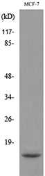 ACBP Rabbit Polyclonal Antibody