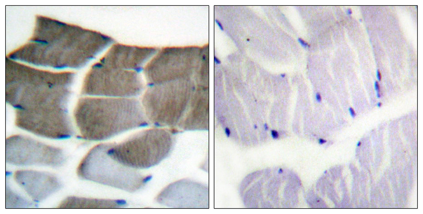 ACCα Rabbit Polyclonal Antibody