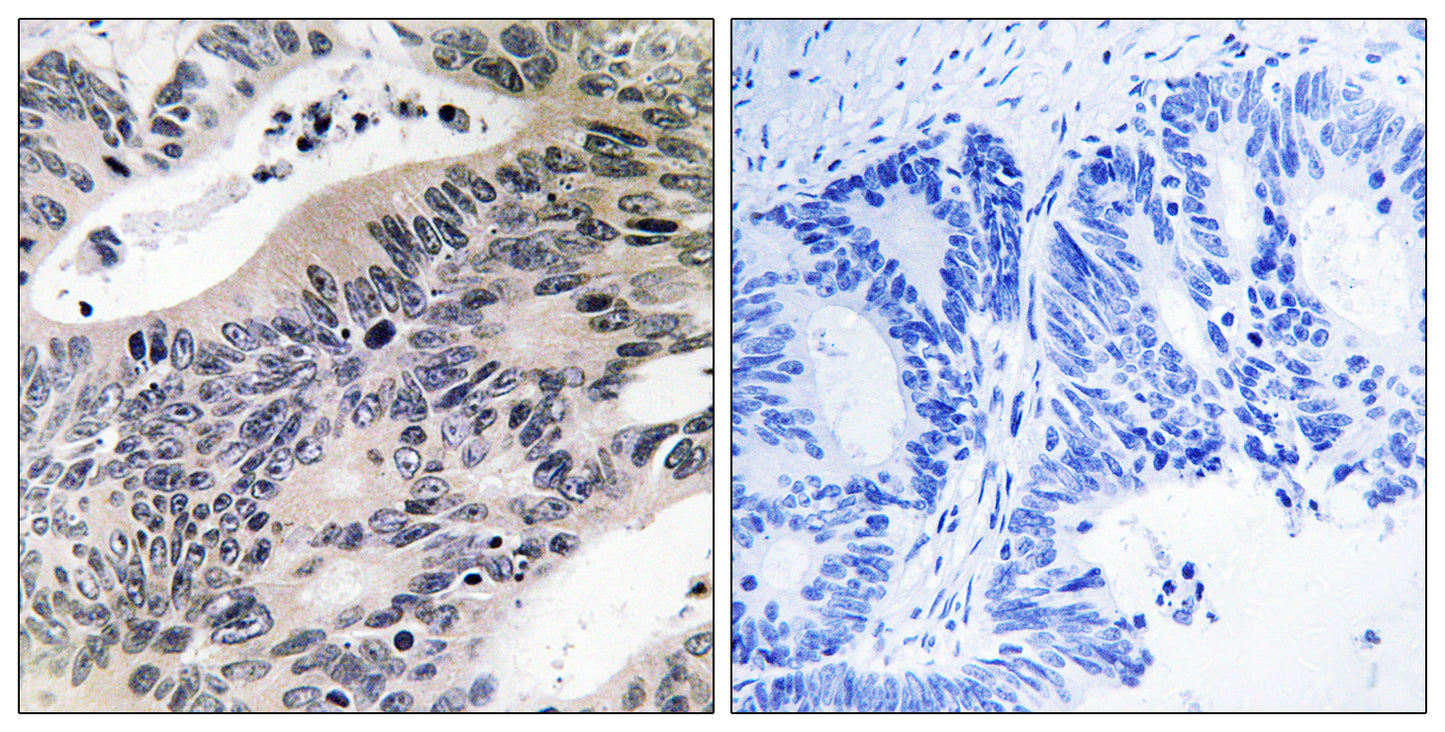 ACSS1 Rabbit Polyclonal Antibody