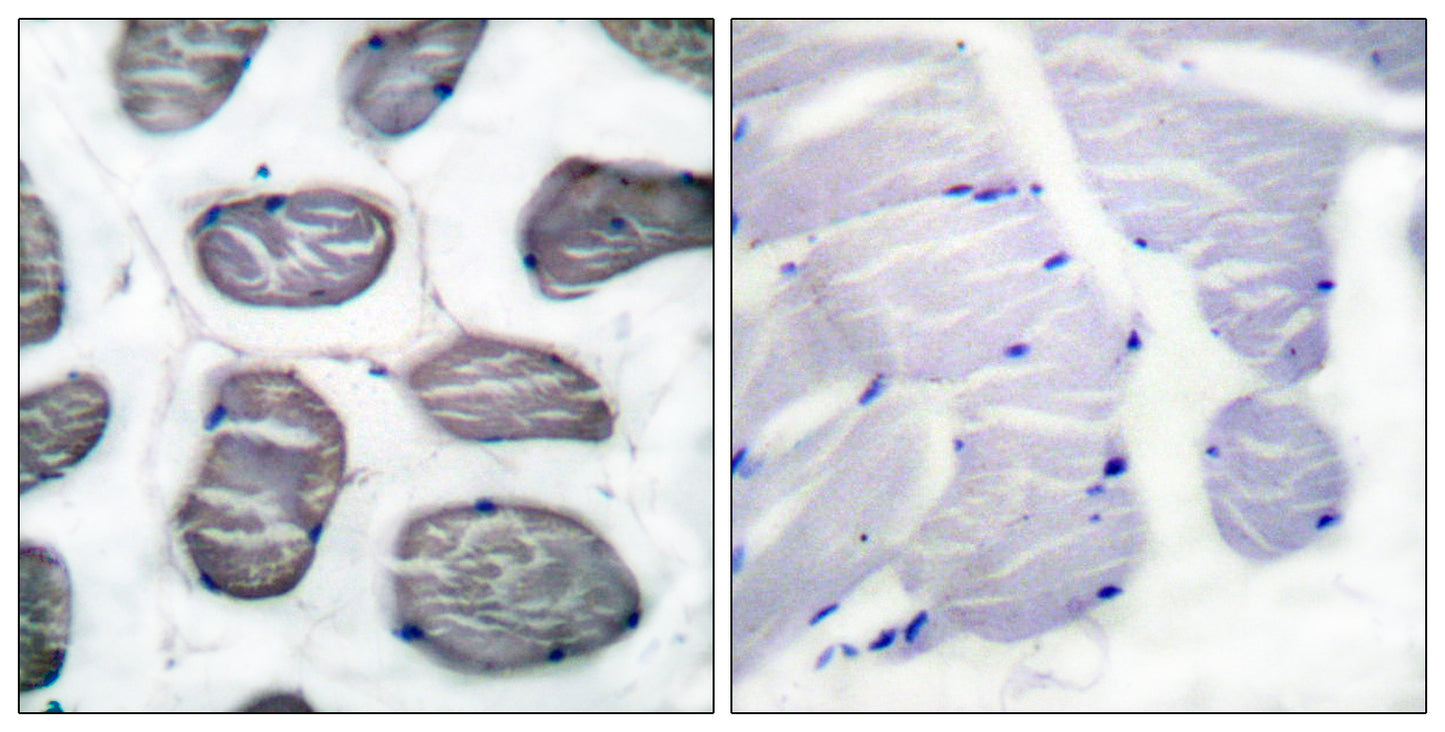 Actin α1 Rabbit Polyclonal Antibody