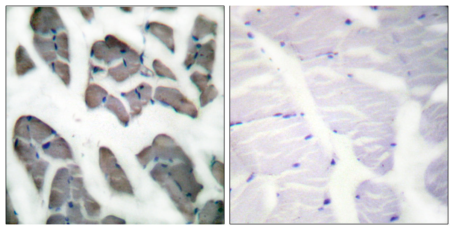 Actin α3 Rabbit Polyclonal Antibody