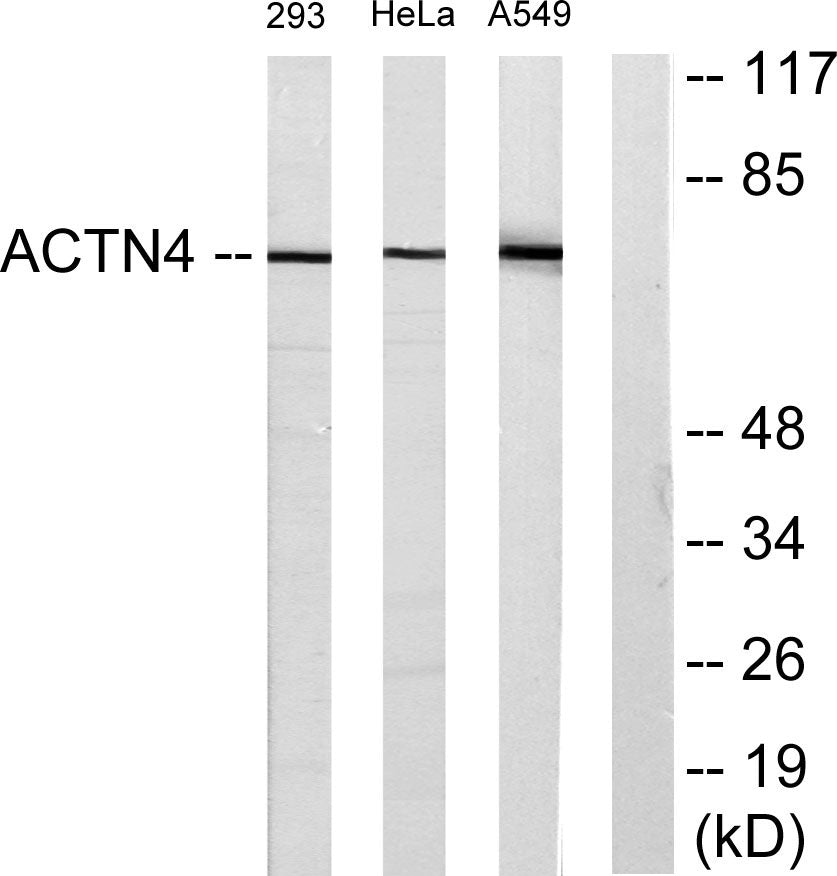 Actinin-α1/2/3/4 Rabbit Polyclonal Antibody
