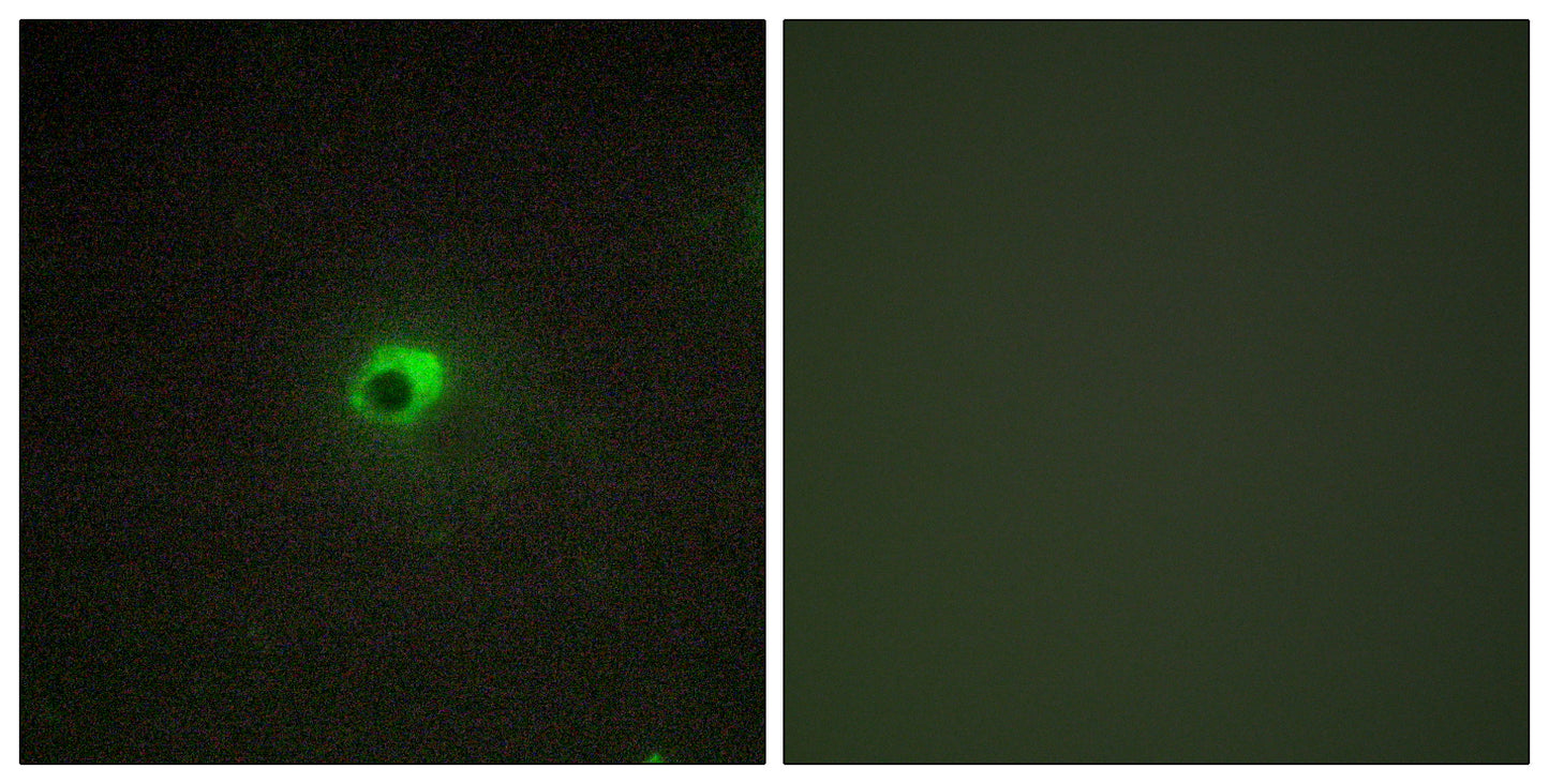 ACTR-IC Rabbit Polyclonal Antibody