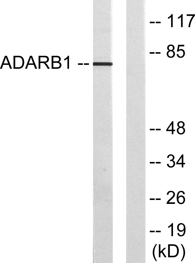 ADAR2 Rabbit Polyclonal Antibody