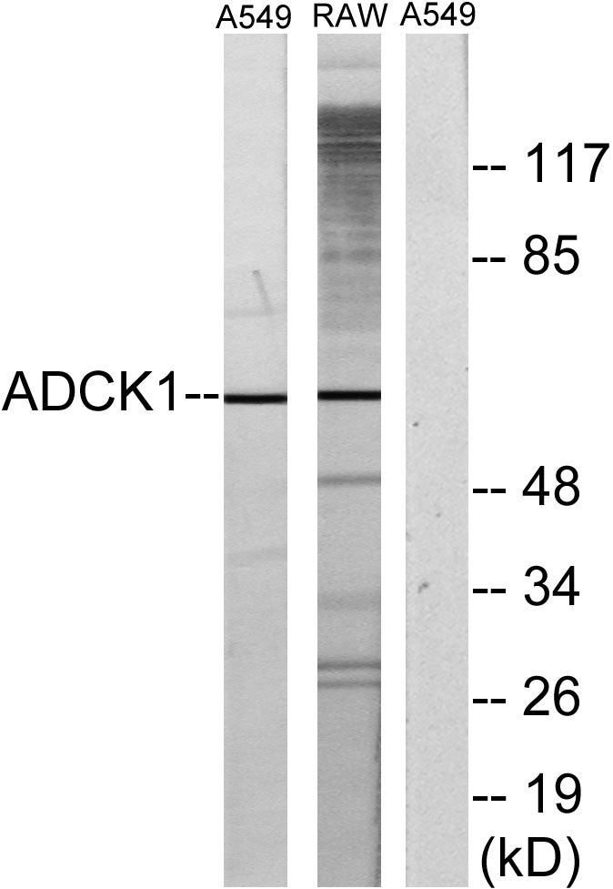 ADCK1 Rabbit Polyclonal Antibody