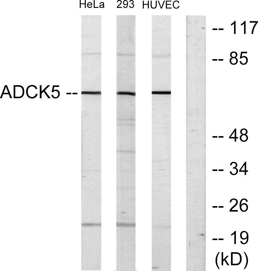 ADCK5 Rabbit Polyclonal Antibody