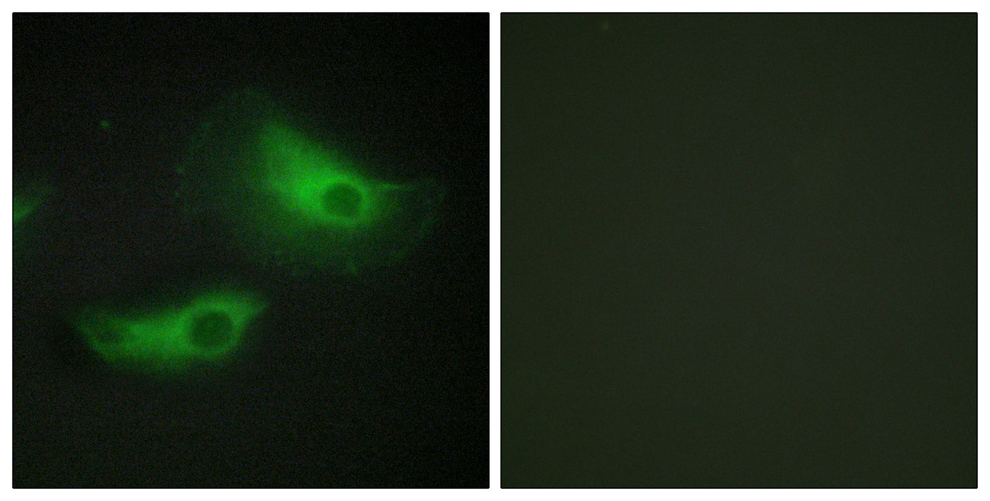 Adducin β Rabbit Polyclonal Antibody