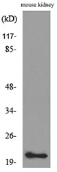 ADM Rabbit Polyclonal Antibody