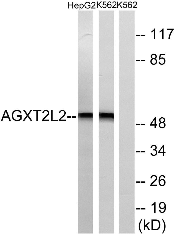 AGXT2L2 Rabbit Polyclonal Antibody