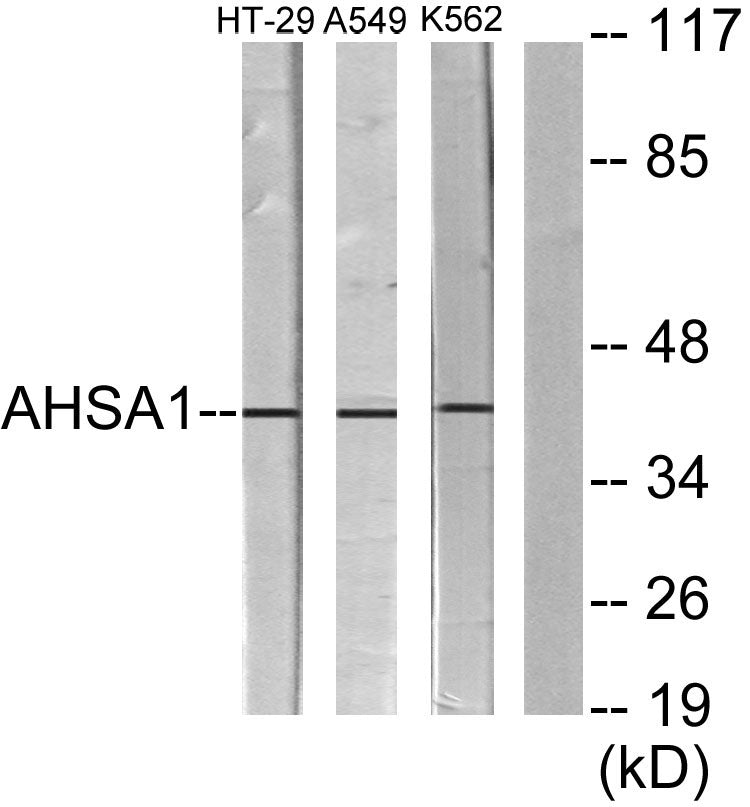 AHA-1 Rabbit Polyclonal Antibody