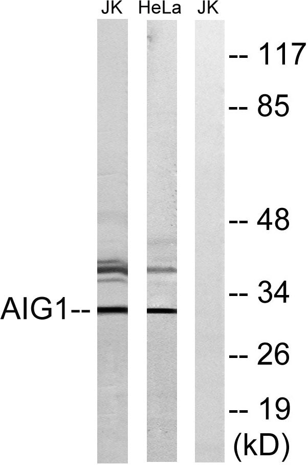 AIG-1 Rabbit Polyclonal Antibody