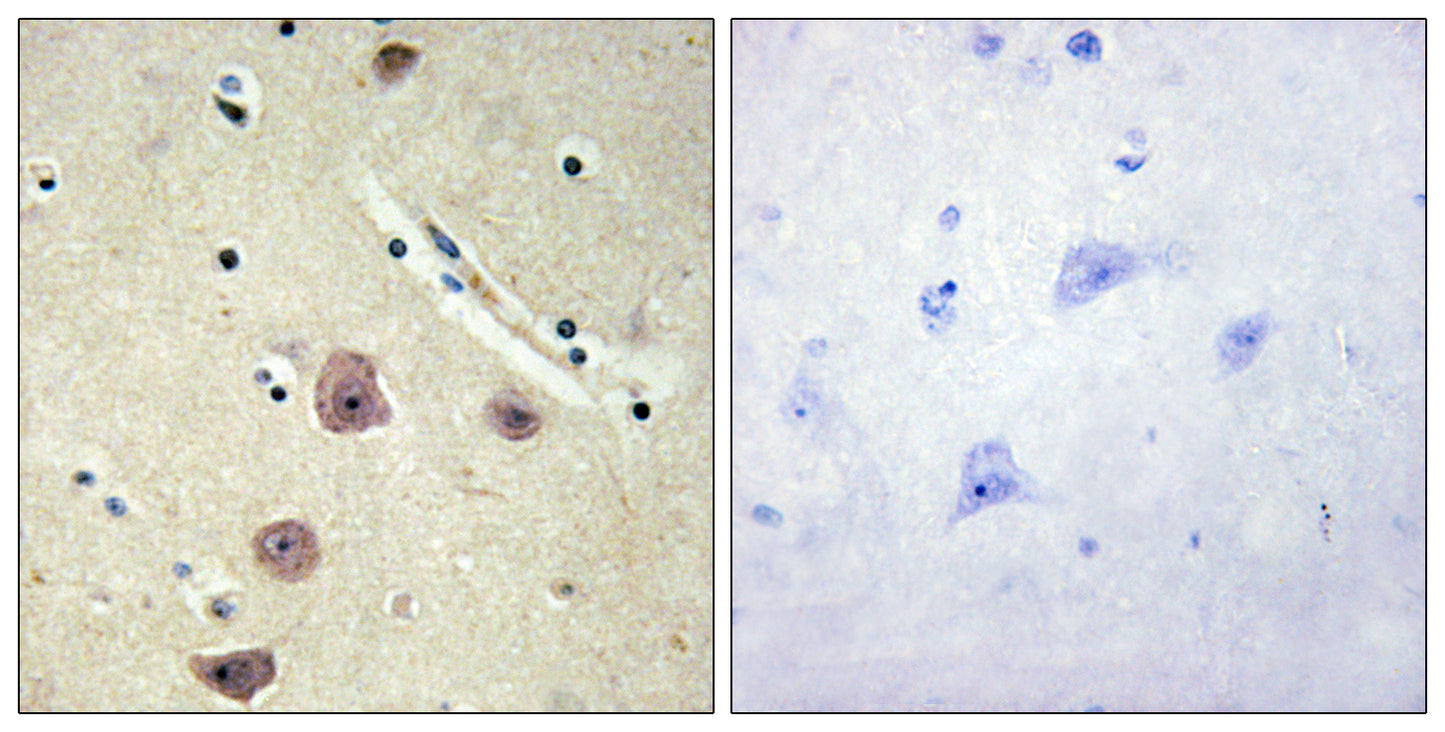 AK5 Rabbit Polyclonal Antibody