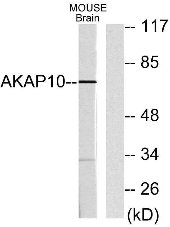 AKAP 10 Rabbit Polyclonal Antibody