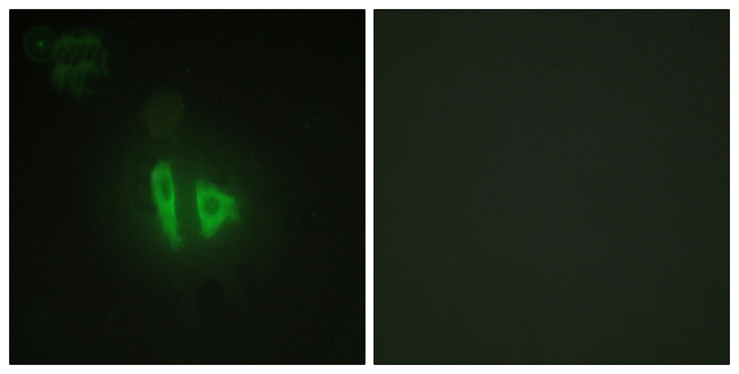 AKAP 220 Rabbit Polyclonal Antibody