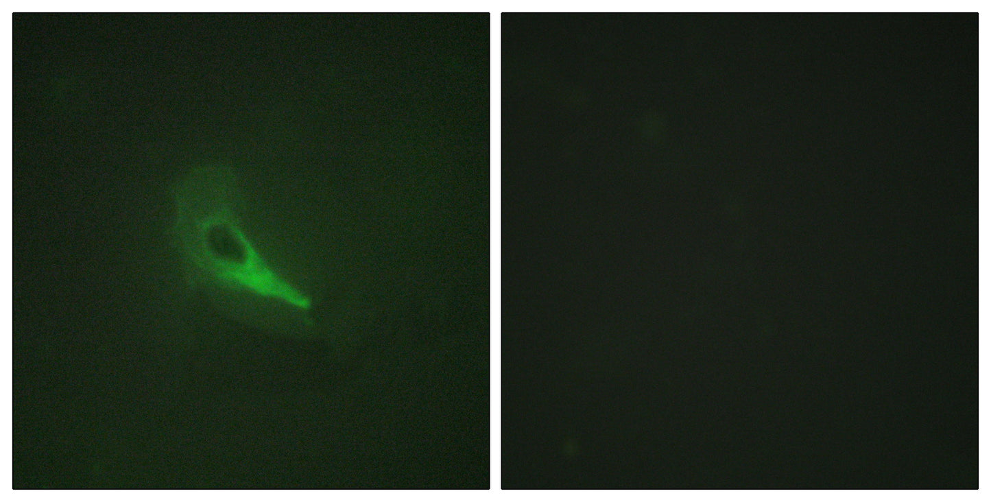 AKAP 250 Rabbit Polyclonal Antibody