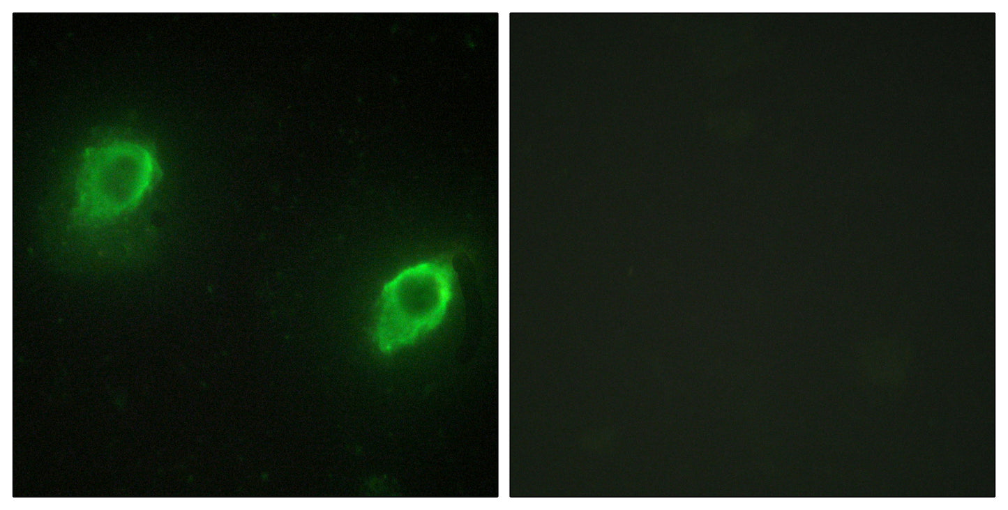 AKAP 79 Rabbit Polyclonal Antibody