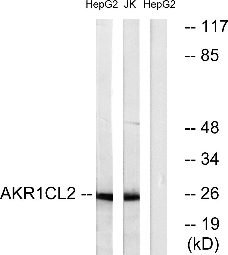 AKR1CL2 Rabbit Polyclonal Antibody