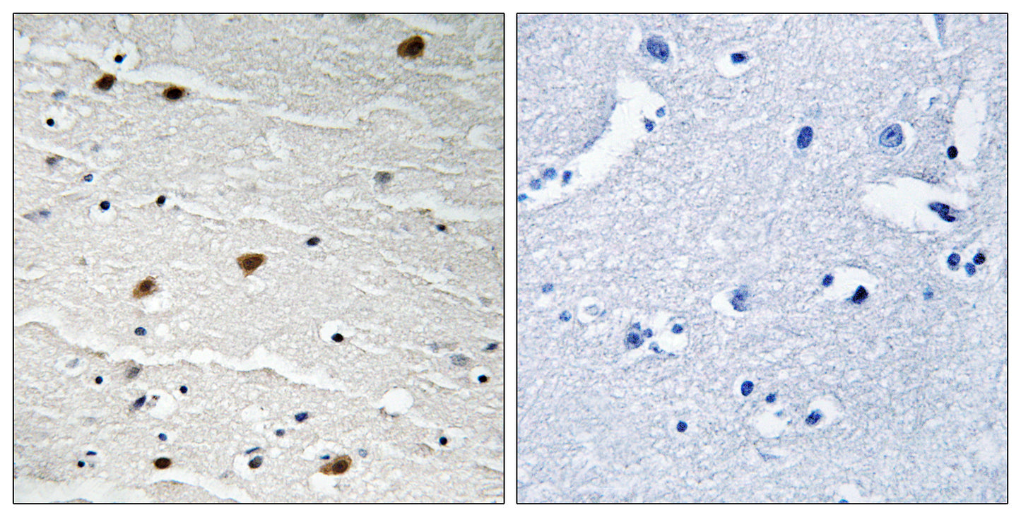 Akt Rabbit Polyclonal Antibody