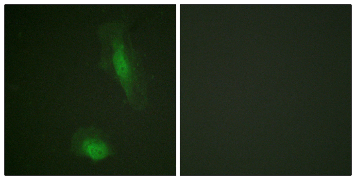 Akt1 Rabbit Polyclonal Antibody